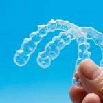 Invisalign Warszawa cena