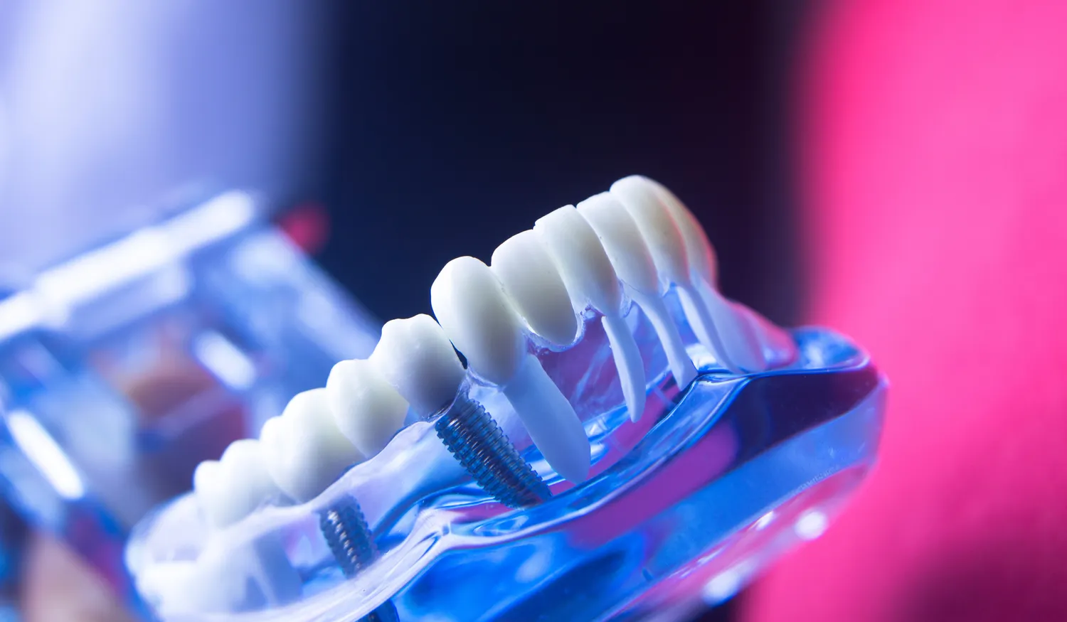 Dentysta czy stomatolog?
